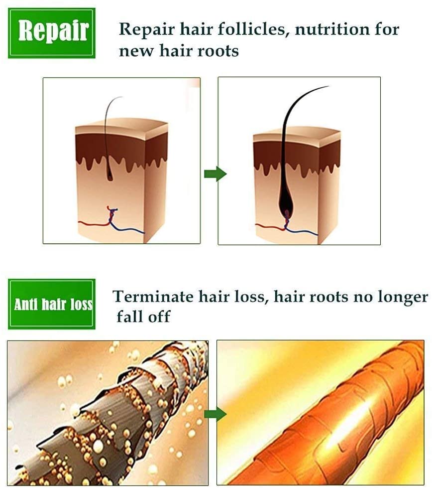  Sérum de crecimiento del cabello, tratamiento para el cabello y fortalece los folículos para el crecimiento del cabello, ayuda al crecimiento del cabello. 