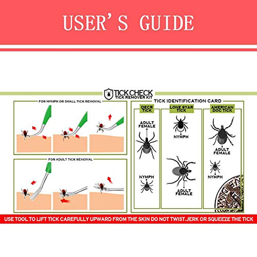 La Eliminación De Garrapatas Conjunto De Herramientas De 2 Piezas De Acero Inoxidable Tick Pinzas Herramienta De Limpieza De Forma Segura Quickly Extracción Segura De Las Garrapatas Del Perro Del Gato