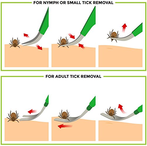 TickCheck Kit removedor de garrapatas (removedor de garrapatas de Acero Inoxidable con Pinzas, Estuche de Cuero y Tarjeta de identificación de garrapatas de Bolsillo) Envase de 1