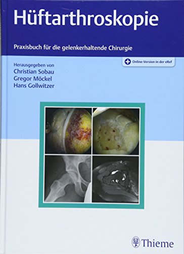 Hüftarthroskopie: Praxisbuch für die gelenkerhaltende Chirurgie